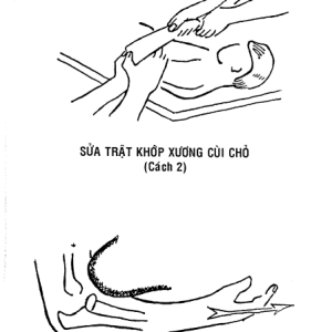 Trật Đả Cốt Khoa – Võ Sư Từ Thiện Hồ Tường